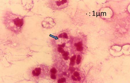グラム染色を行ったパスツレラ属菌の画像