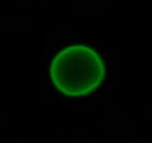 クリプトスポリジウムの落射蛍光顕微鏡像